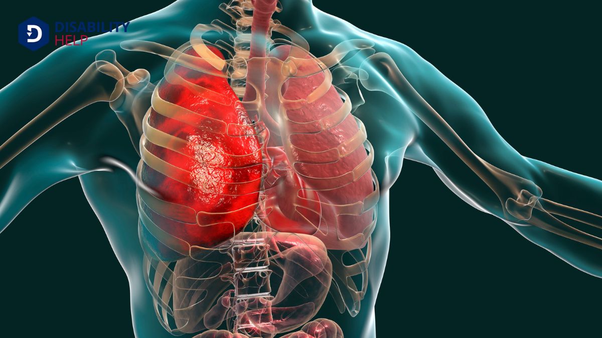 10 Best Benefits for Respiratory Conditions